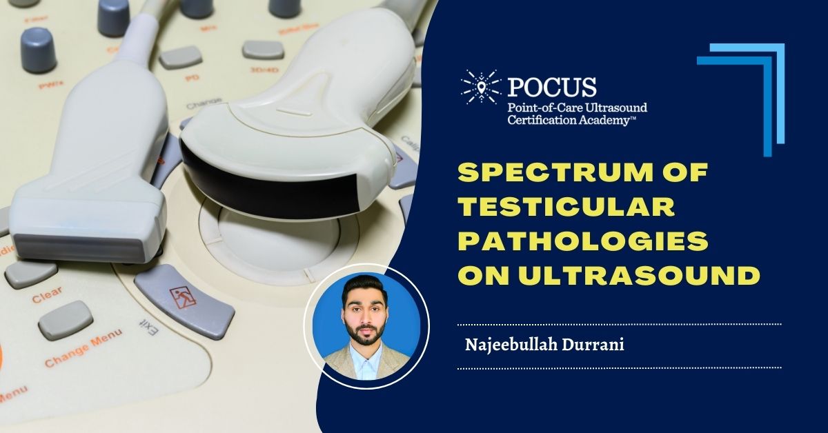 Spectrum Of Testicular Pathologies On Ultrasound Point Of Care