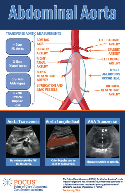 aortic measurements pocus ultrasound abdominal transverse aorta aaa point care aneurysm using