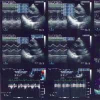 Point-of-Care Ultrasound Cardiac Exams - Point-of-Care Ultrasound ...