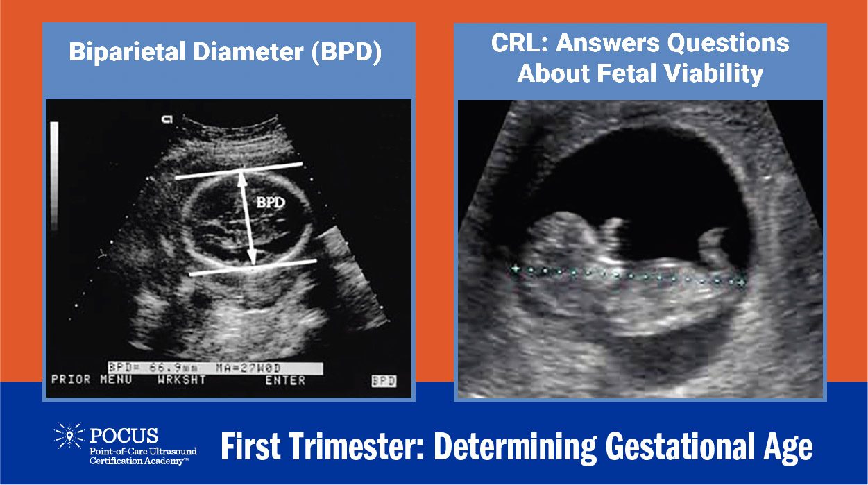 Normal Fetal Biometry Of A 16 Weeks Gestational Age 52 Off 