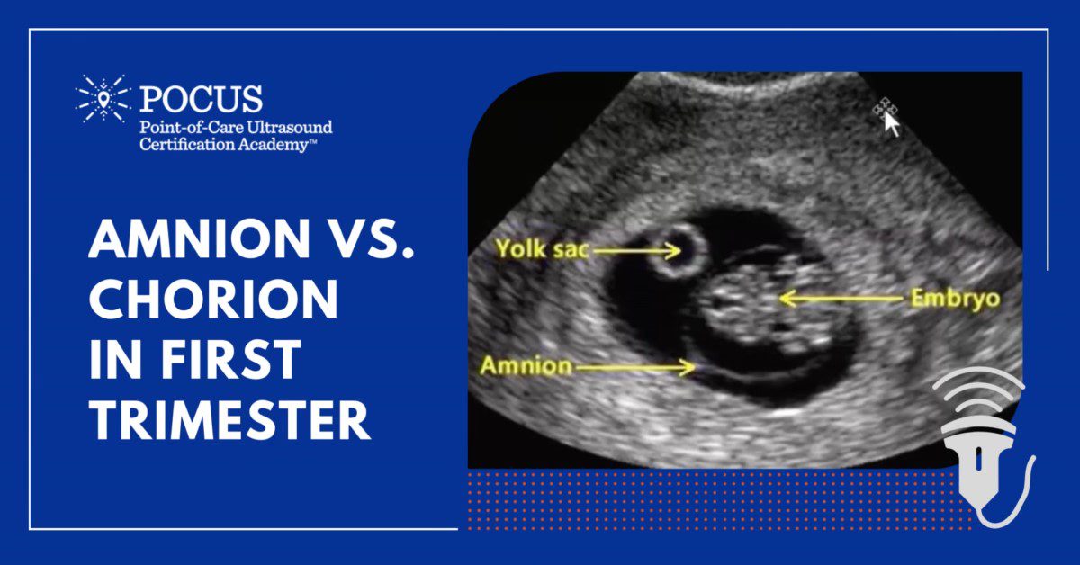 Amnion Vs Chorion In The 1st Trimester POCUS Resources Case Studies 