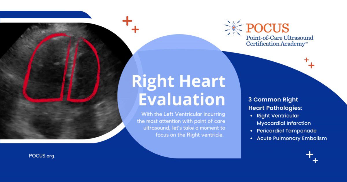 Right Heart Evaluation Point Of Care Ultrasound Certification Academy 5828