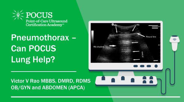 Pneumothorax – Can POCUS Lung Help? - Point-of-Care Ultrasound ...