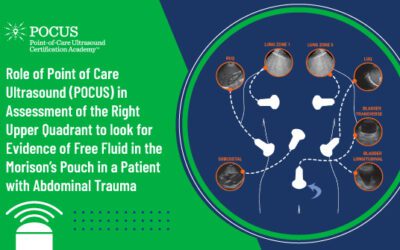Role of Point of Care Ultrasound (POCUS) in Assessment of the Right Upper Quadrant to look for Evidence of Free Fluid in the Morison’s Pouch in a Patient with Abdominal Trauma