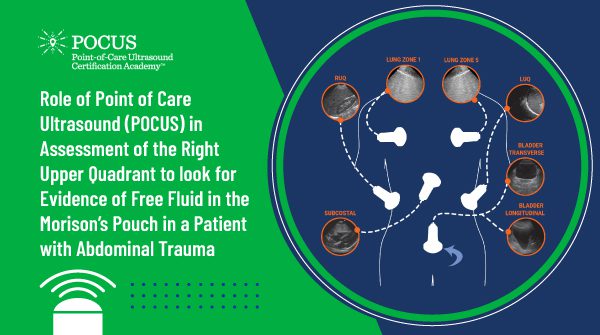 Role of Point of Care Ultrasound (POCUS) in Assessment of the Right Upper Quadrant to look for Evidence of Free Fluid in the Morison’s Pouch in a Patient with Abdominal Trauma