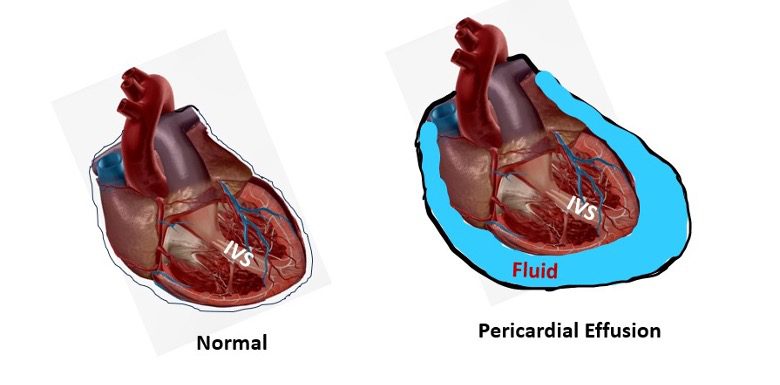 Heart anatomy diagram