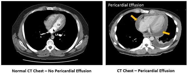 CT scan