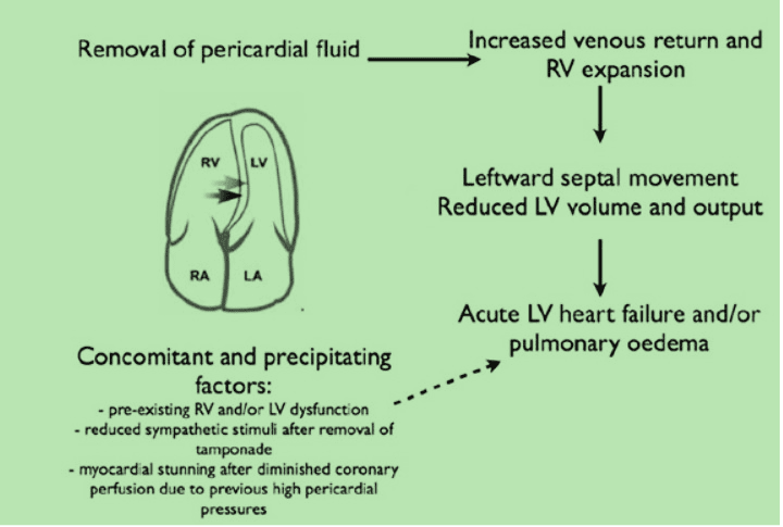 Cardiac decompression