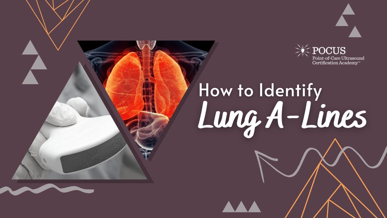 How To Identify Lung A-Lines | POCUS Resources & Case Studies | POCUS.org