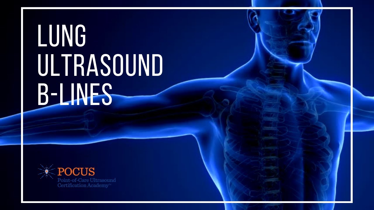 BLUE Protocol: B-Lines | POCUS Resources & Case Studies | POCUS.org