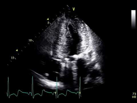 Cardiac Scanning | POCUS Resources & Case Studies | POCUS.org